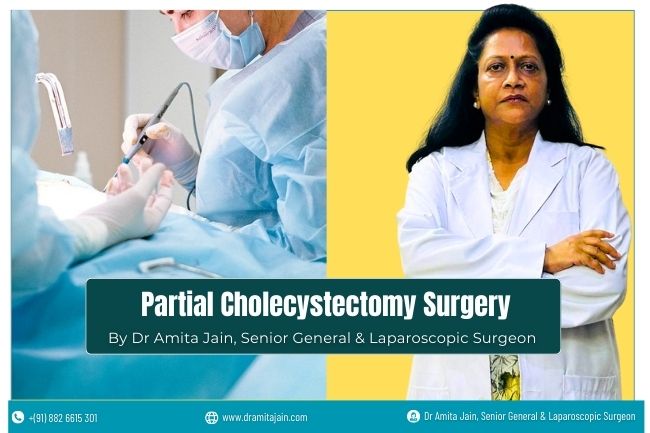 Best Partial Cholecystectomy Gallbladder Surgeon Dr Amita Jain